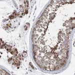 Atlas Antibodies Anti-NGLY1 Antibody