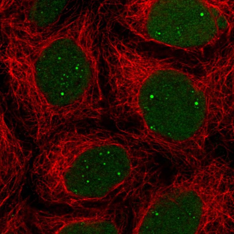Atlas Antibodies Anti-NHEJ1 Antibody