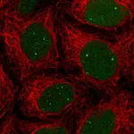 Atlas Antibodies Anti-NHEJ1 Antibody