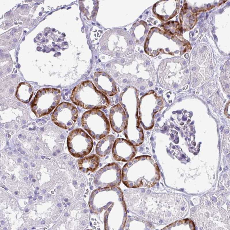 Atlas Antibodies Anti-NHLH2 Antibody