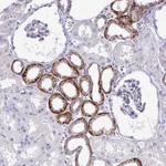 Atlas Antibodies Anti-NHLH2 Antibody