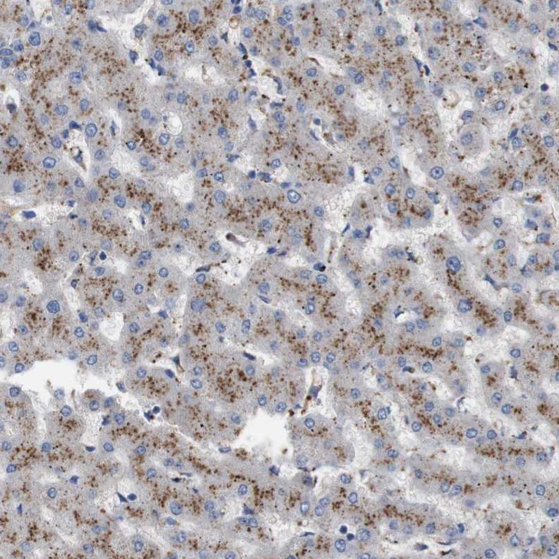 Atlas Antibodies Anti-NHLRC3 Antibody