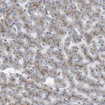 Atlas Antibodies Anti-NHLRC3 Antibody