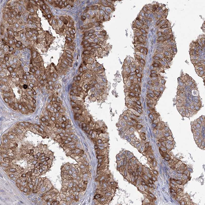 Atlas Antibodies Anti-NHLRC2 Antibody