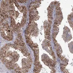 Atlas Antibodies Anti-NHLRC2 Antibody