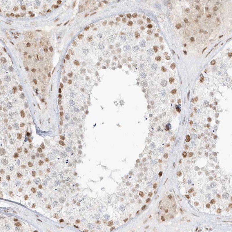 Atlas Antibodies Anti-NHSL1 Antibody