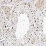 Atlas Antibodies Anti-NHSL1 Antibody