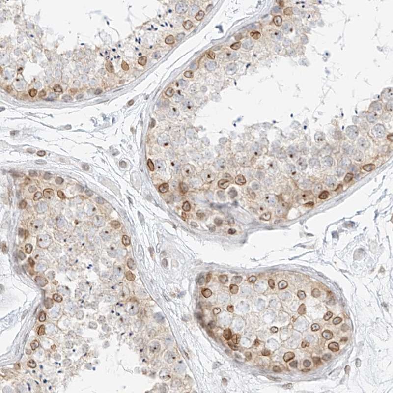 Atlas Antibodies Anti-NHSL1 Antibody