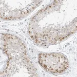 Atlas Antibodies Anti-NHSL1 Antibody