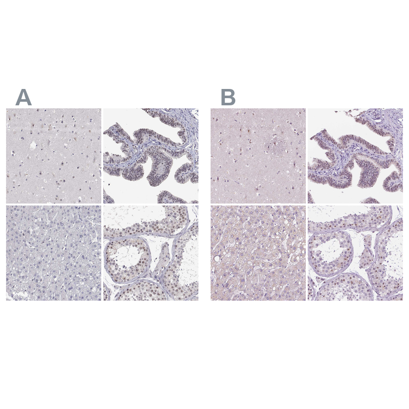 Atlas Antibodies Anti-NHP2 Antibody