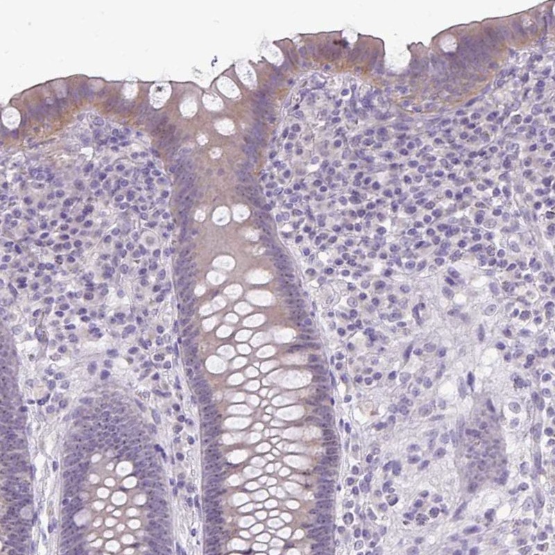 Atlas Antibodies Anti-NHSL2 Antibody