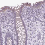 Atlas Antibodies Anti-NHSL2 Antibody