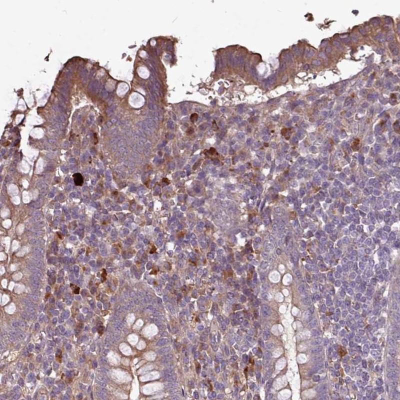 Atlas Antibodies Anti-NHSL2 Antibody
