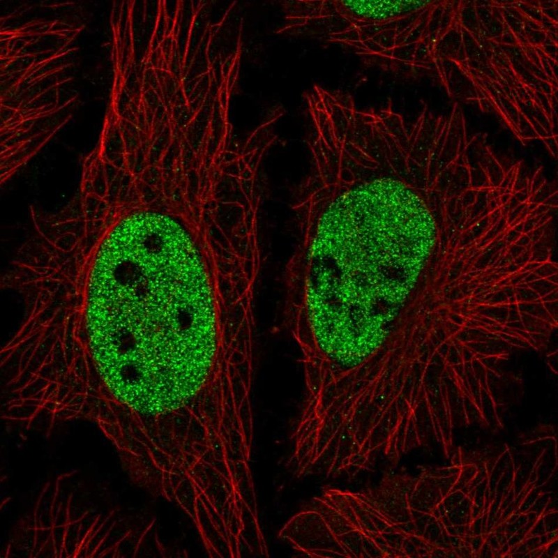 Atlas Antibodies Anti-NICN1 Antibody