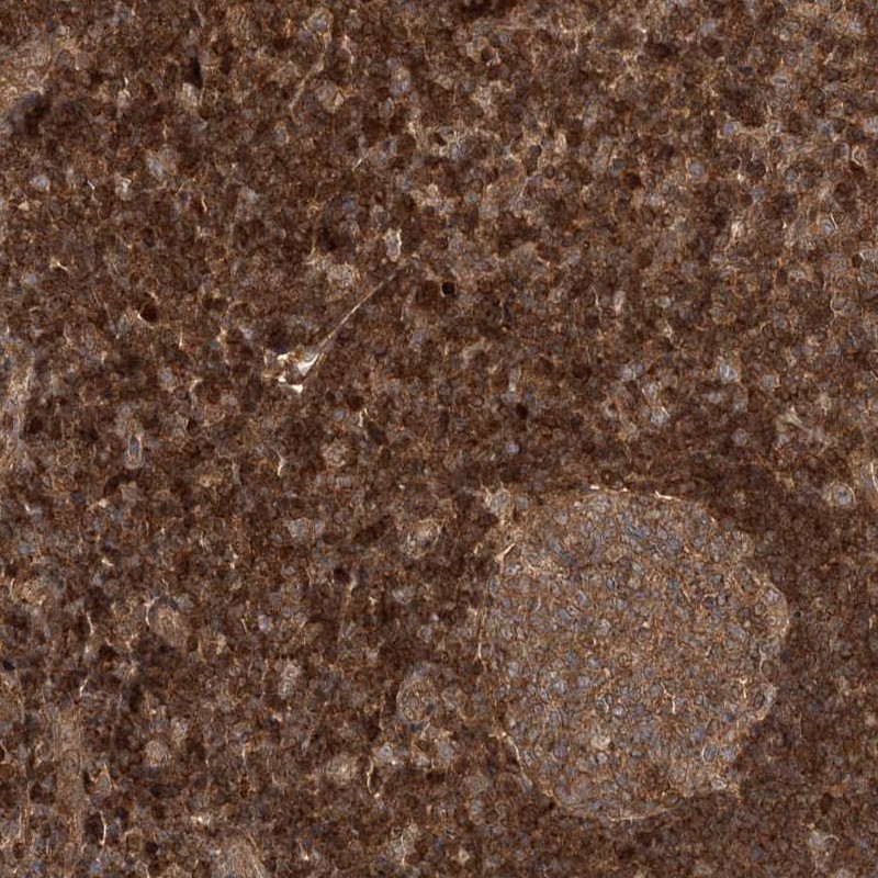 Atlas Antibodies Anti-NIF3L1 Antibody