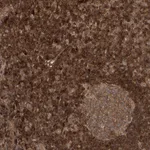Atlas Antibodies Anti-NIF3L1 Antibody