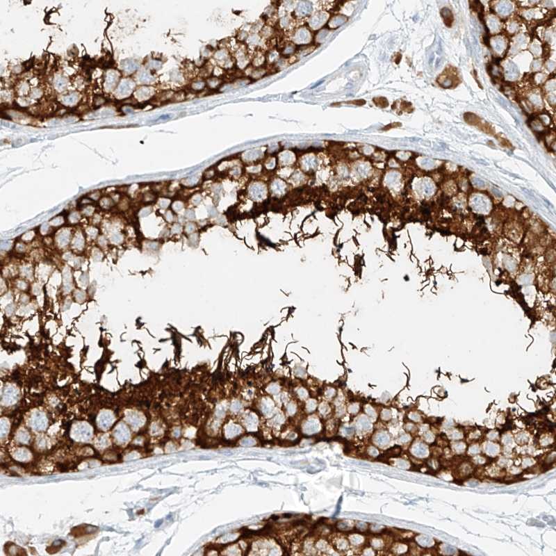 Atlas Antibodies Anti-NHSL1 Antibody
