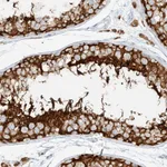 Atlas Antibodies Anti-NHSL1 Antibody