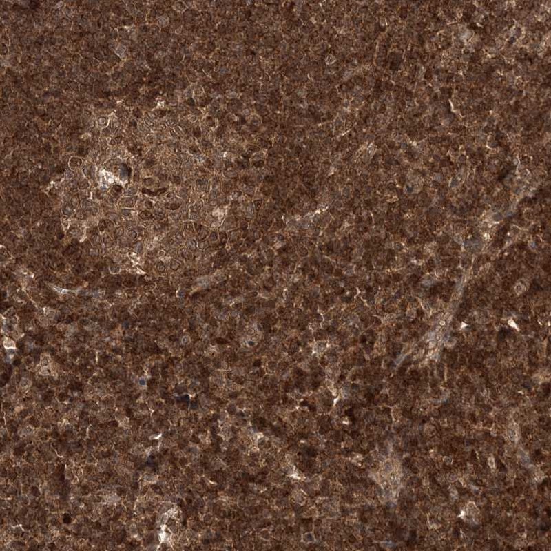 Atlas Antibodies Anti-NIF3L1 Antibody