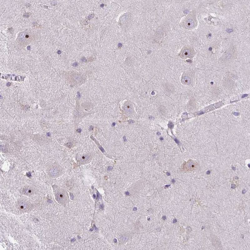 Atlas Antibodies Anti-NIFK Antibody