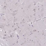 Atlas Antibodies Anti-NIFK Antibody