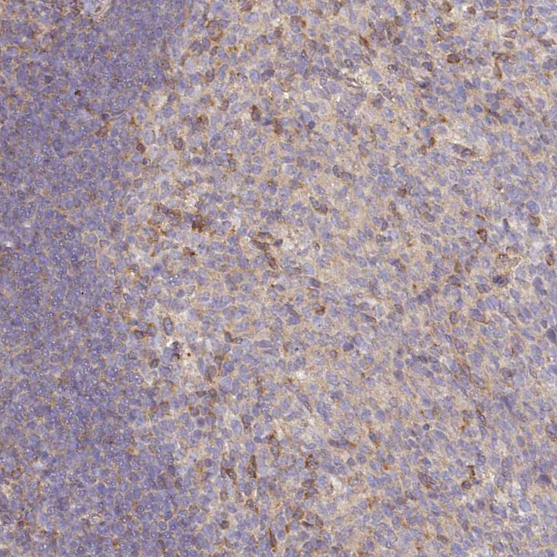 Atlas Antibodies Anti-NIN Antibody