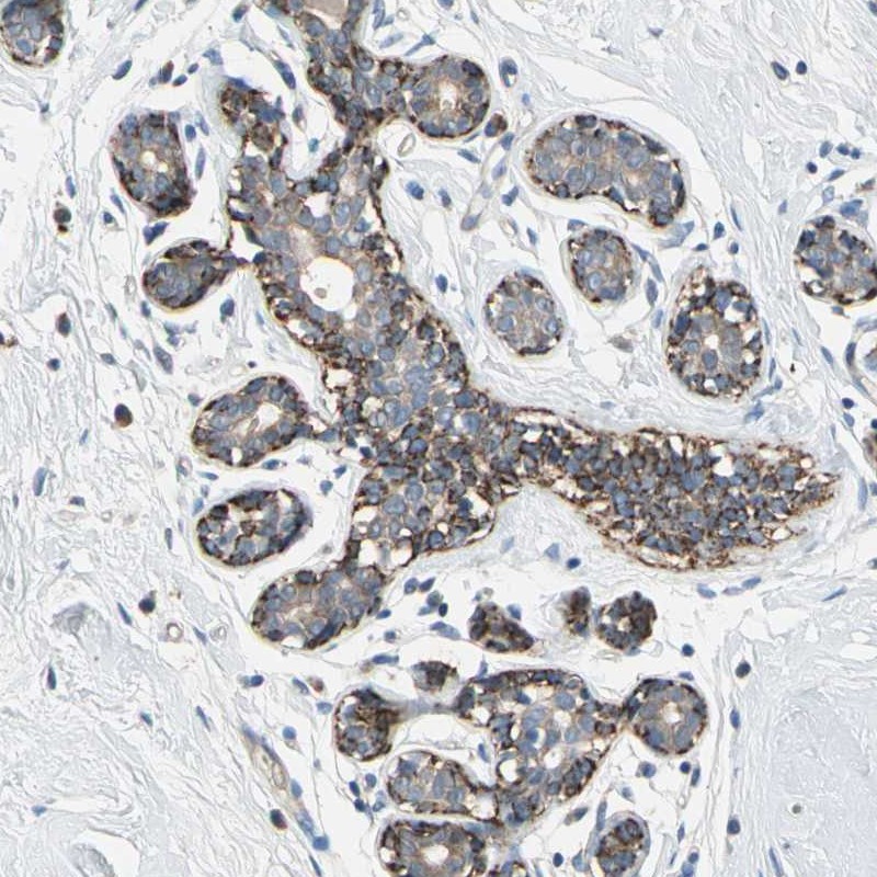 Atlas Antibodies Anti-NIM1K Antibody