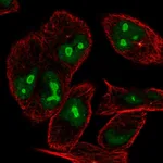 Atlas Antibodies Anti-NIN Antibody