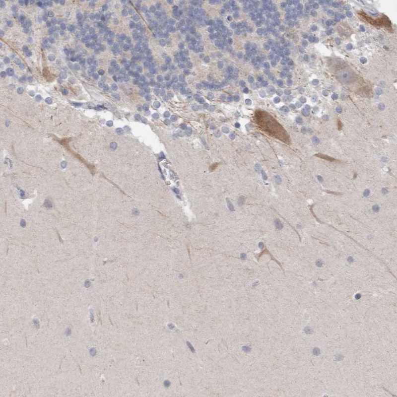 Atlas Antibodies Anti-NIPA1 Antibody