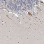 Atlas Antibodies Anti-NIPA1 Antibody