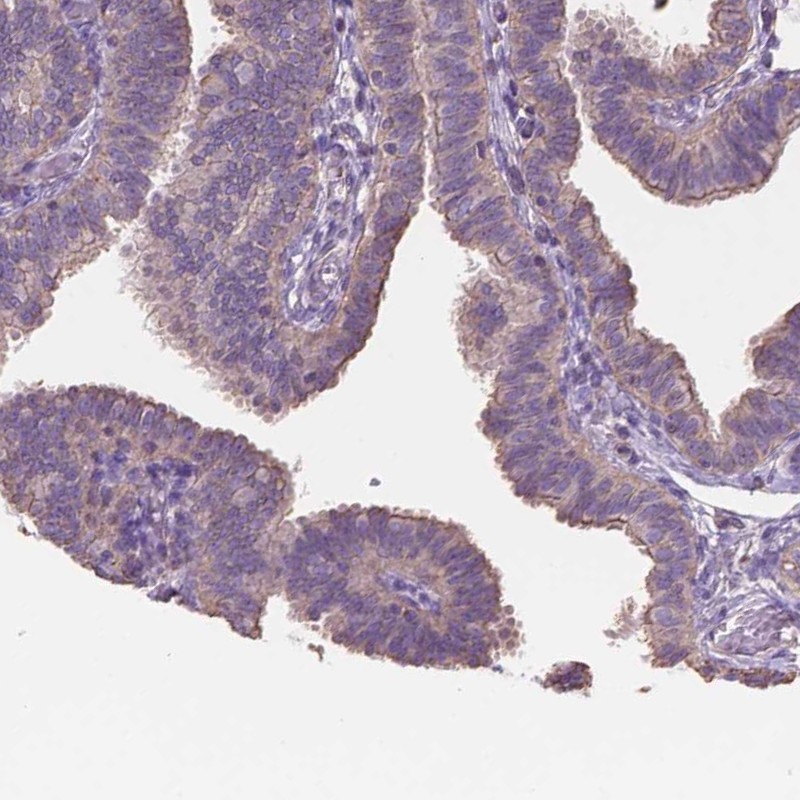 Atlas Antibodies Anti-NIPA2 Antibody