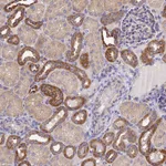 Atlas Antibodies Anti-NIPSNAP3A Antibody