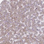 Atlas Antibodies Anti-NIPSNAP1 Antibody