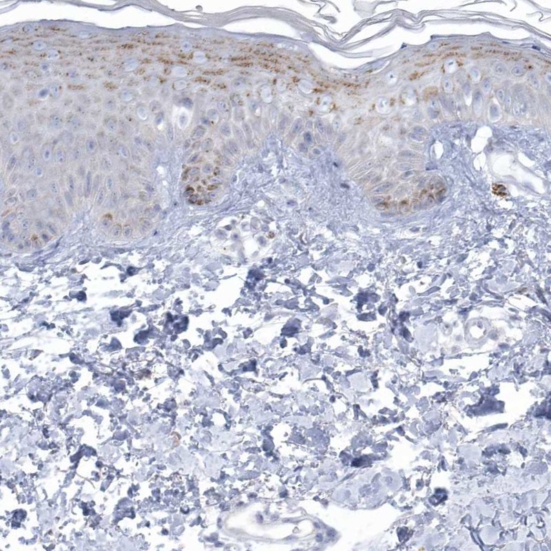 Atlas Antibodies Anti-NIPAL1 Antibody