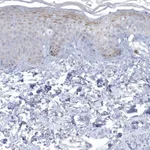 Atlas Antibodies Anti-NIPAL1 Antibody
