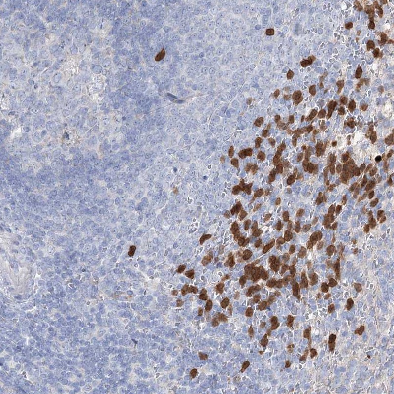Atlas Antibodies Anti-NIPAL4 Antibody
