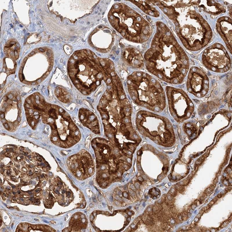 Atlas Antibodies Anti-NIPAL3 Antibody