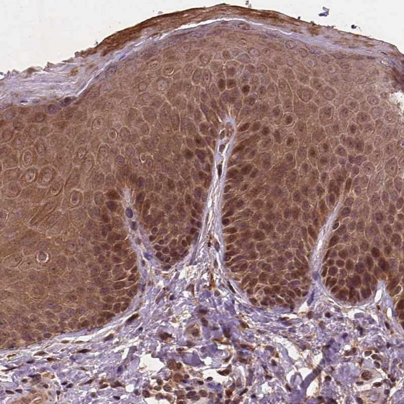 Atlas Antibodies Anti-NIPAL2 Antibody