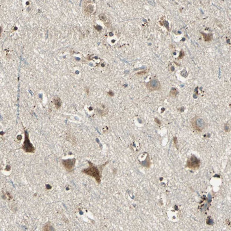 Atlas Antibodies Anti-NIT1 Antibody