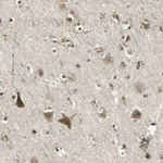 Atlas Antibodies Anti-NIT1 Antibody