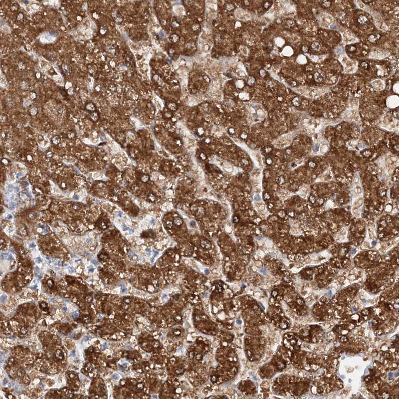 Atlas Antibodies Anti-NIT2 Antibody