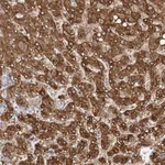 Atlas Antibodies Anti-NIT2 Antibody