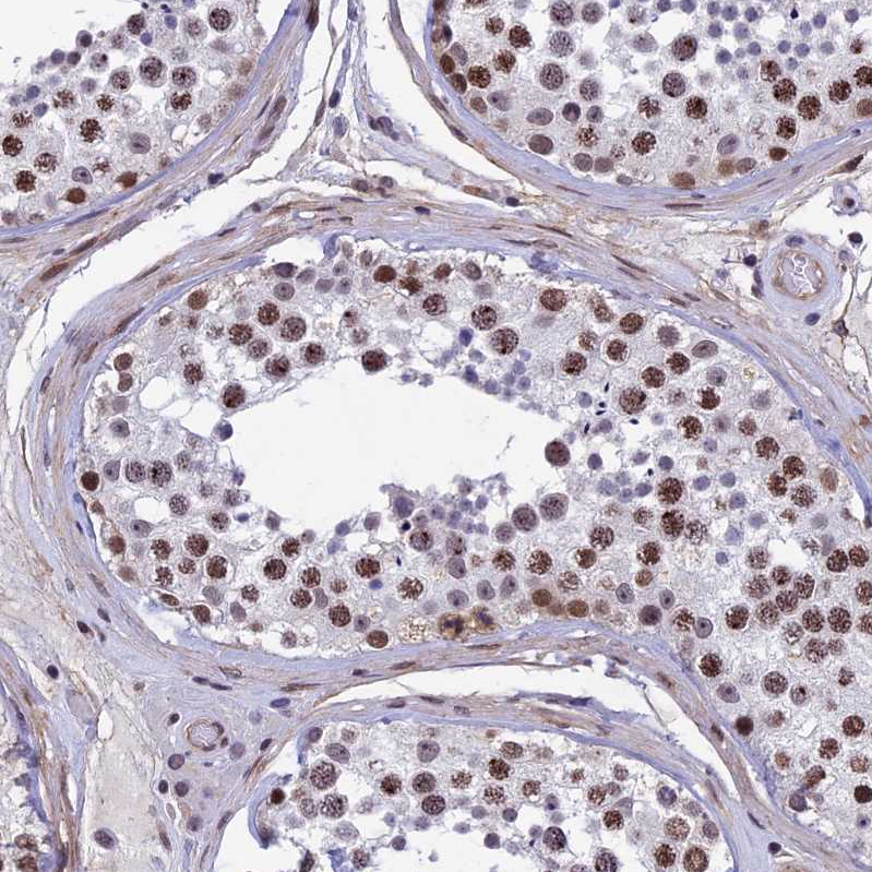 Atlas Antibodies Anti-NIPBL Antibody