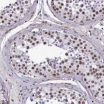 Atlas Antibodies Anti-NIPBL Antibody