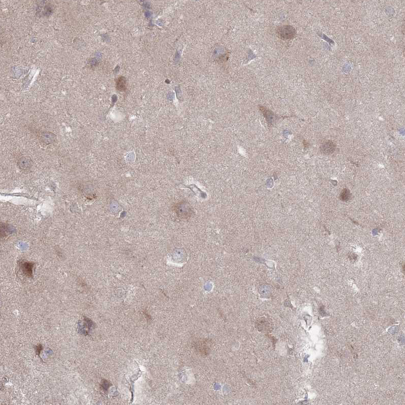 Atlas Antibodies Anti-NKD1 Antibody