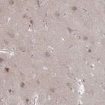 Atlas Antibodies Anti-NKD1 Antibody