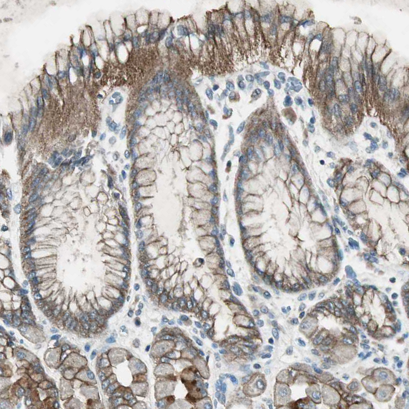 Atlas Antibodies Anti-NKAIN1 Antibody