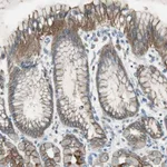 Atlas Antibodies Anti-NKAIN1 Antibody