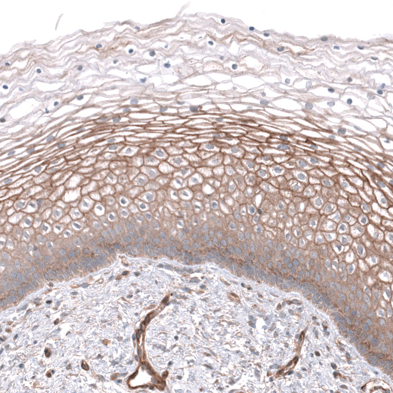 Atlas Antibodies Anti-NKAIN4 Antibody