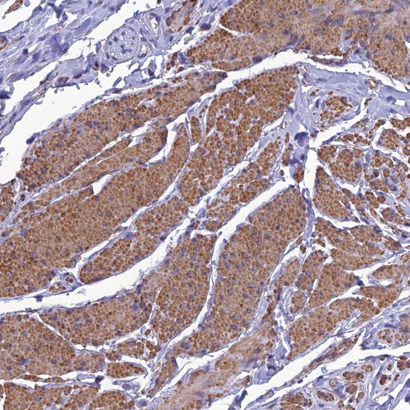 Atlas Antibodies Anti-NKD1 Antibody